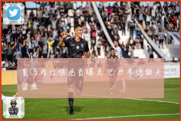 皇马内讧伤疤首曝光 巴尔韦德额头留痕